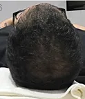 6週間後