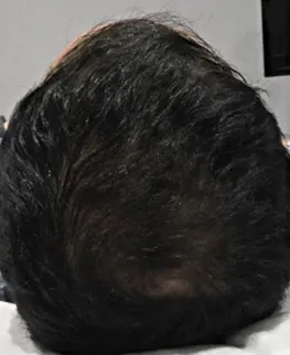 7週間後