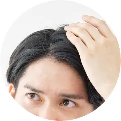 生え際の改善